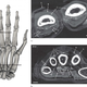 (a) top view of the skeletal hand; (b) cross-sections of the hand showing interior detail.